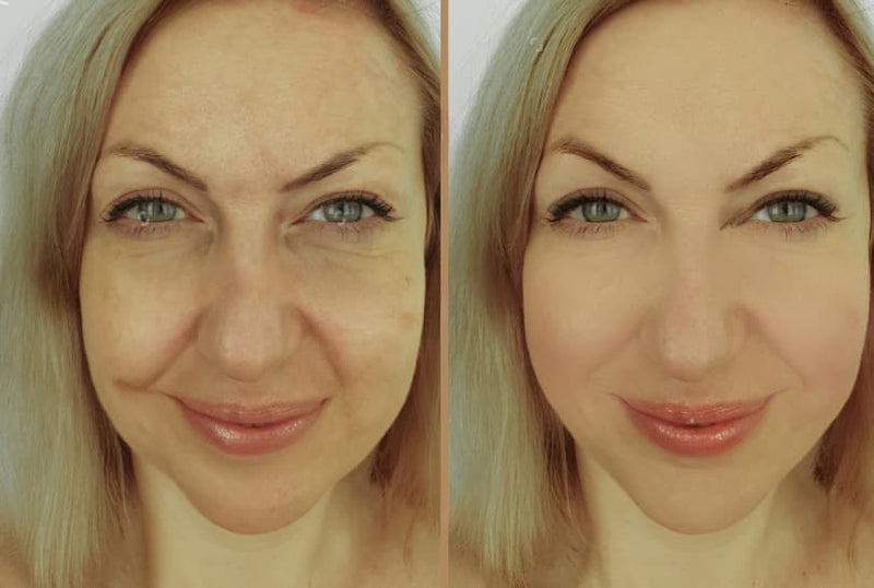 Brighter, more even tone