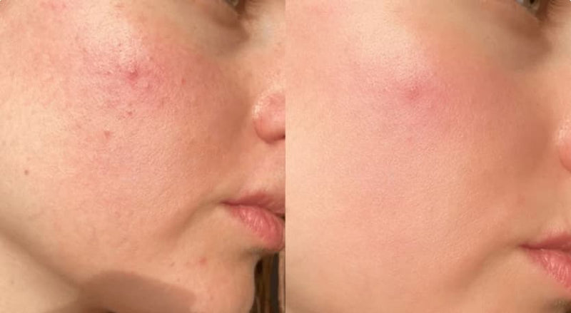Visibly fewer active breakouts