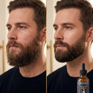 Men's Beard Oil — 6-Oil Blend with Argan, Jojoba & Sea Buckthorn | Choose Your Scent | Visions of You Beautiful