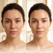The Clear Slate Set — Niacinamide, Prickly Pear Serum & Aloe Cleanser Bundle | Visions of You Beautiful